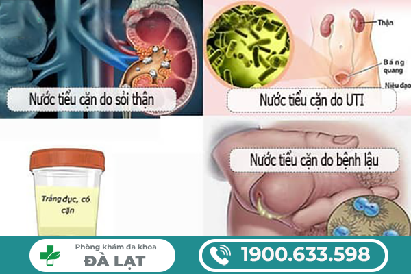 Hình ảnh minh họa